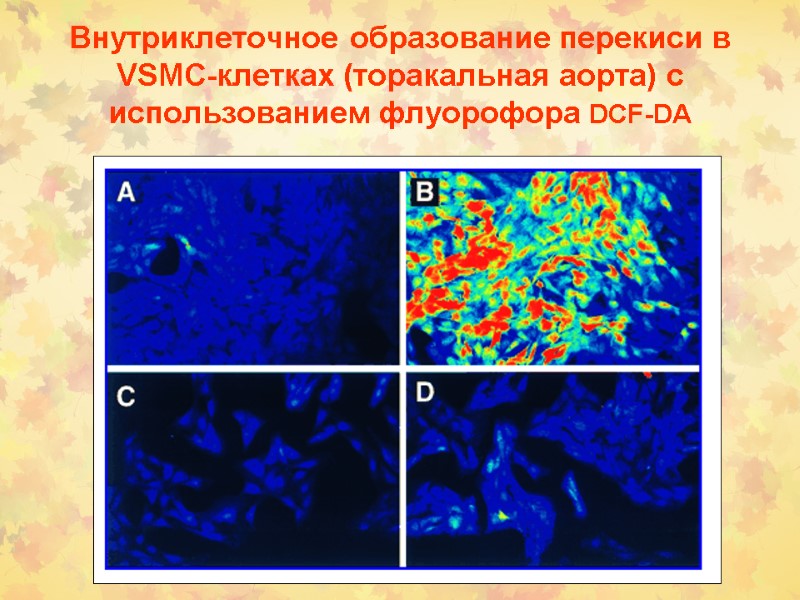 Внутриклеточное образование перекиси в VSMC-клетках (торакальная аорта) с использованием флуорофора DCF-DA